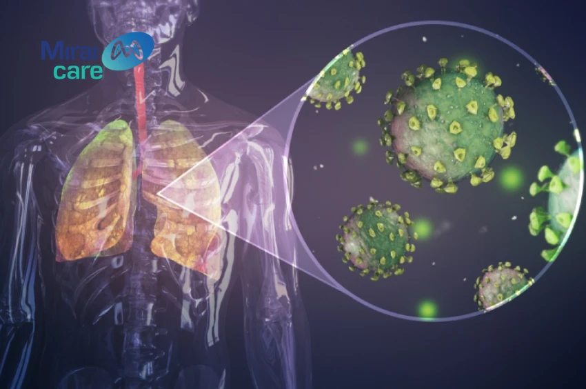 điều trị ung thư phổi bằng liệu pháp miễn dịch